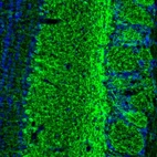 Anti-GABRA3 Antibody