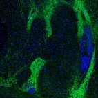 Immunofluorescence staining of mouse ventral pallidum shows strong labeling of synaptic fields.