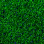 Immunofluorescence staining of mouse insular cortex shows strong immunoreactivity in synapses.