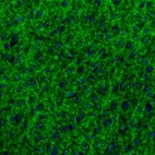 Anti-GABRA3 Antibody