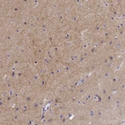 Immunohistochemical staining of human Cerebral cortex shows moderate positivity in neuronal processes in neuropil.