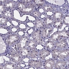 Immunohistochemical staining of human Kidney shows no positivity in cells in tubules as expected.