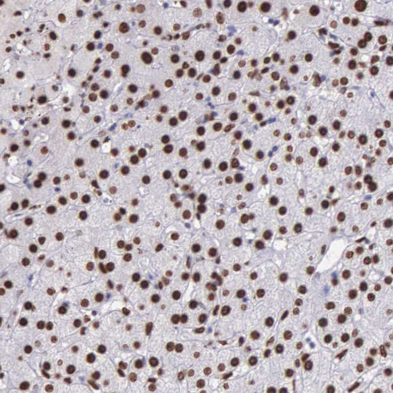 Anti-H1F0 Antibody
