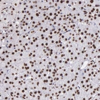 Anti-H1F0 Antibody