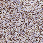 Anti-H1F0 Antibody