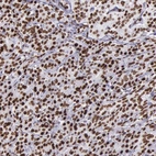 Immunohistochemical staining of human pancreas shows strong nuclear positivity in exocrine glandular cells.