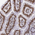 Anti-H1F0 Antibody