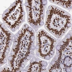 Immunohistochemical staining of human duodenum shows strong nuclear positivity in glandular cells.