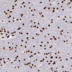 Anti-H1F0 Antibody