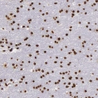 Immunohistochemical staining of human cerebral cortex shows strong nuclear positivity in neurons.
