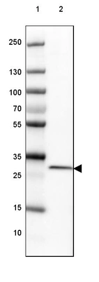 Lane 1: Marker [kDa] 250, 130, 100, 70, 55, 35, 25, 15, 10_br/_Lane 2: Human cell line U-2 OS