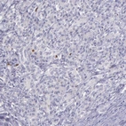 Immunohistochemical staining of human pancreas shows low expression as expected.