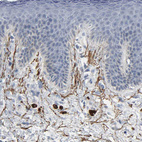 Anti-FBLN5 Antibody