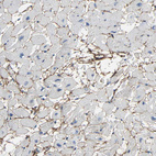 Immunohistochemical staining of human heart muscle shows moderate positivity in extracellular matrix in cardiomyocytes.