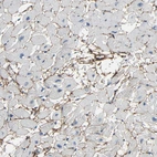 Immunohistochemical staining of human heart muscle shows moderate positivity in extracellular matrix in cardiomyocytes.