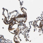 Immunohistochemical staining of human lung shows moderate positivity in extracellular matrix in pneumocytes.