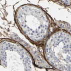 Immunohistochemical staining of human testis shows strong positivity in extracellular matrix in fibrous capsule