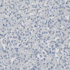 Immunohistochemical staining of human liver shows no positivity in extracellular matrix in hepatocytes as expected.