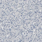Immunohistochemical staining of human liver shows no positivity in extracellular matrix in hepatocytes as expected.