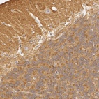 Anti-RALGAPA1 Antibody