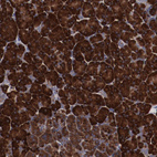 Anti-RPS4X Antibody