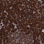 Anti-RPS4X Antibody