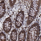 Immunohistochemical staining of human colon shows strong cytoplasmic positivity in glandular cells.