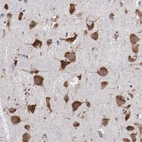 Immunohistochemical staining of human cerebral cortex shows strong cytoplasmic positivity in neurons.