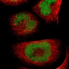 Immunofluorescent staining of human cell line A-431 shows localization to nucleus.