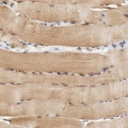 Immunohistochemical staining of human skeletal muscle shows moderate cytoplasmic positivity in myocytes.