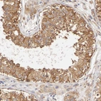 Immunohistochemical staining of human testis shows moderate to strong cytoplasmic positivity in cells in seminiferous ducts.