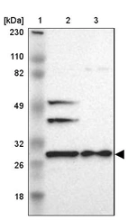 Lane 1: Marker [kDa] 230, 110, 82, 49, 32, 26, 18_br/_Lane 2: Human cell line RT-4_br/_Lane 3: Human cell line U-251MG sp