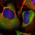 Immunofluorescent staining of human cell line U-2 OS shows localization to cytosol.