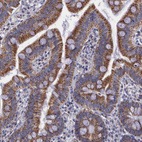 Anti-SYNJ2BP Antibody