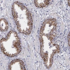 Immunohistochemical staining of human prostate shows strong granular cytoplasmic positivity in glandular cells.
