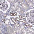 Anti-SYNJ2BP Antibody