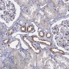 Immunohistochemical staining of human kidney shows moderate granular cytoplasmic positivity in cells in distal tubules.