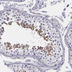 Anti-SYNJ2BP Antibody