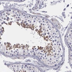 Immunohistochemical staining of human testis shows moderate granular cytoplasmic positivity in cells in seminiferous ducts.