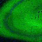 Anti-SYNJ2BP Antibody