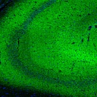 Immunofluorescence staining of mouse hippocampus shows strong positivity in synapses.