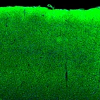 Immunofluorescence staining of mouse parietal association cortex shows strong positivity in synapses .