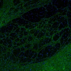 Immunofluorescence staining of mouse globus pallidus.shows weak positivity in synapses and neuronal processes.