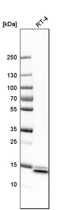 Western blot analysis in human cell line RT-4.