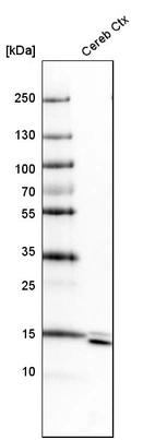 Western blot analysis in mouse cerebral cortex tissue.