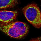 Immunofluorescent staining of human cell line A-431 shows localization to mitochondria.