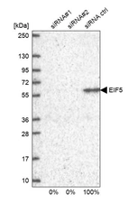 Western blot analysis in U2OS cells transfected with control siRNA, target specific siRNA probe #1 and #2, using Anti-EIF5 antibody. Remaining relative intensity is presented.