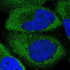 Immunofluorescent staining of human cell line A-431 shows localization to cytosol.