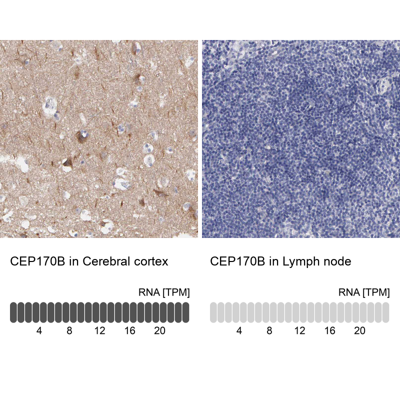 Anti-CEP170B Antibody