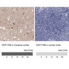 Anti-CEP170B Antibody